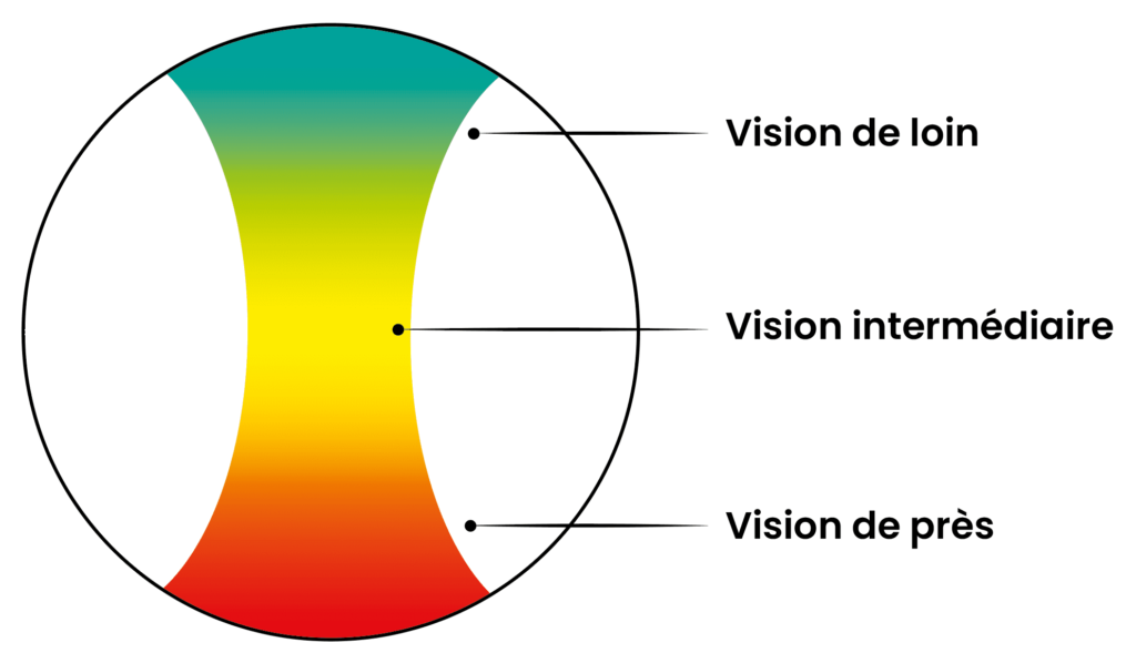 verres progressifs potentiel vision lyon