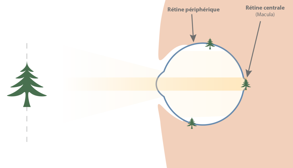 oeil parfait vision nette